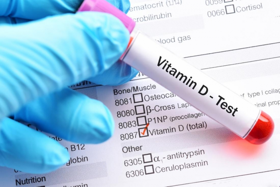 П.Нямцэрэн: Хүн амын 98 хувь нь витамин Д-гийн дутагдалтай байна